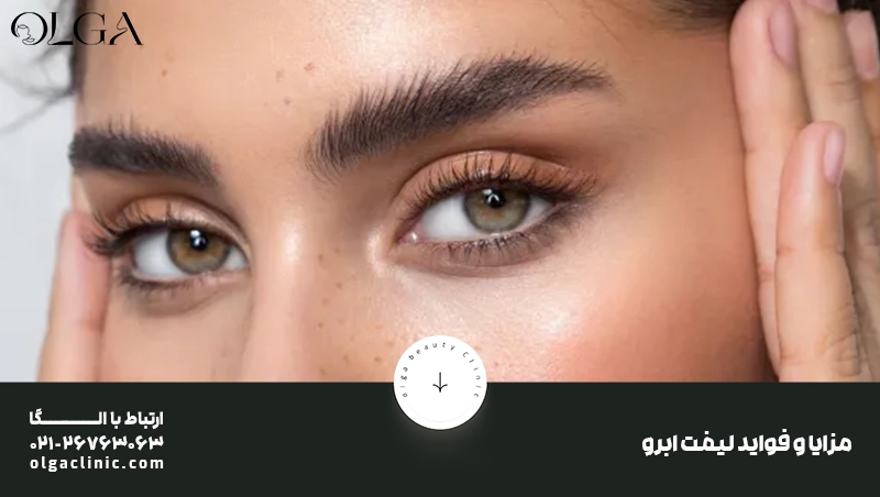 مزایا و فواید لیفت ابرو